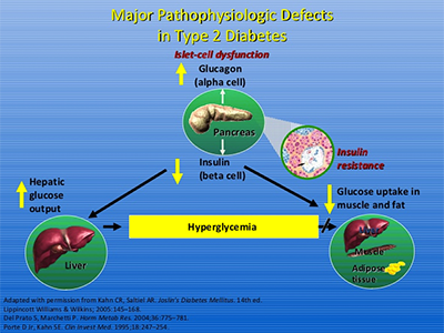Major Pathophysiologic Defects in Type 2 Diabetes Major Pathophysiologic Defects in Type 2 Diabetes