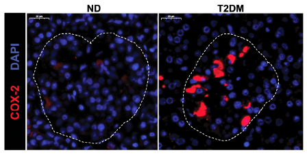 Cox-2 activation Image in human T2D islets